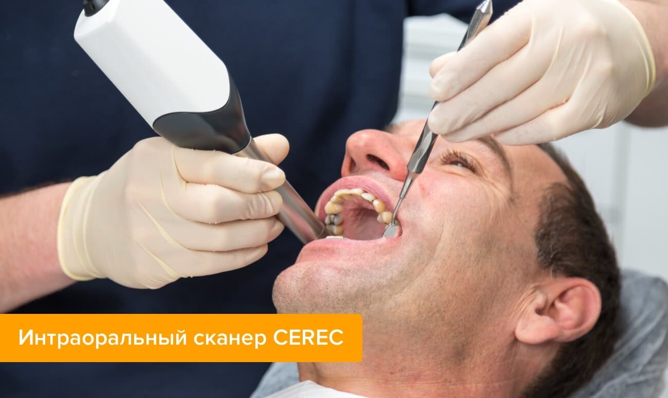 Фото интраорального сканера CEREC 