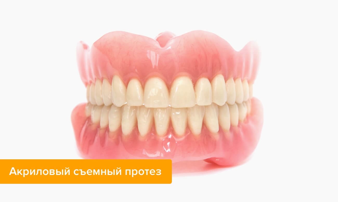 Фото акрилового съемного протеза